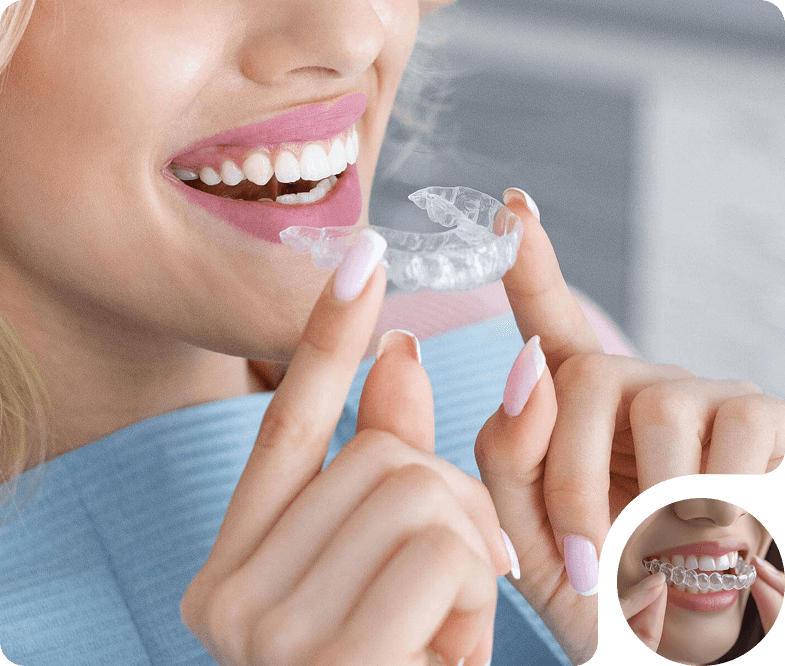 What Are Dental Aligners?