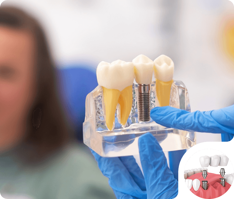 How do Dental Implants Work?
