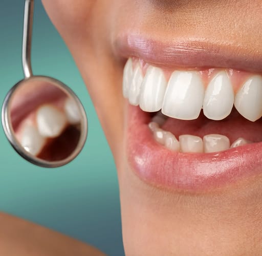 Fillings